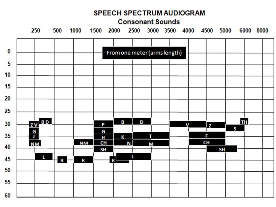 Audiogram Speech Banana Chart