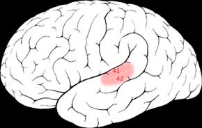 brain aud cortex