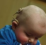 Infant_with_cochlear_implant