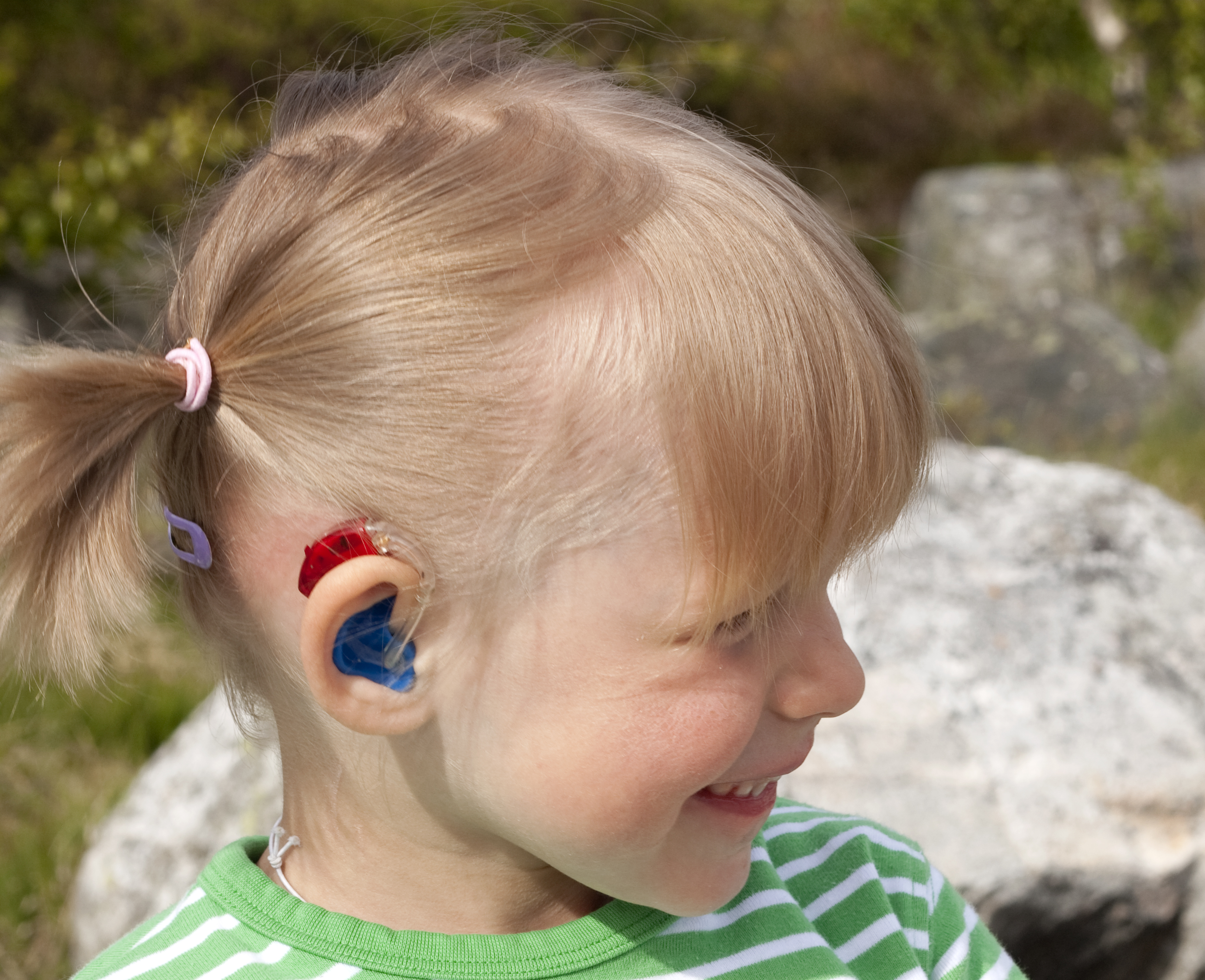 Child with hearing aid Young female child wearing hearing aid and outdoors